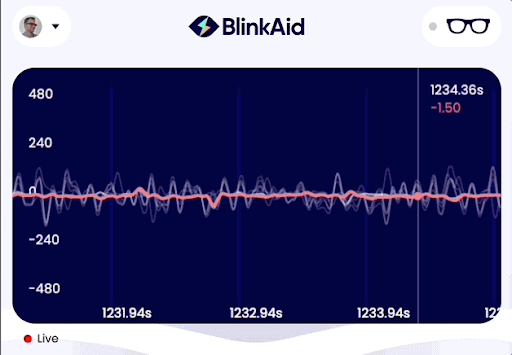 Real-time EMG signal during rightward gaze